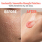 💐50% OFF ! Hydrating Body Scrub – Exfoliates & Nourishes Skin 🌸🧴【Limited Offer】