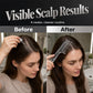 💇✨Buy 1 Get 1 Free! 🌟🔍 Scalp Applicator Comb Tool for Hair – Precision application, even flow delivery, and gentle rolling contact. Perfect for your daily scalp care routine! 💚 Loved by 6,821+ happy users!