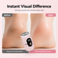 Electric Foot Grinder, Callus Remover Pedicure Tool, 6 Speeds with 5 Grinding Heads, 20000 RPM